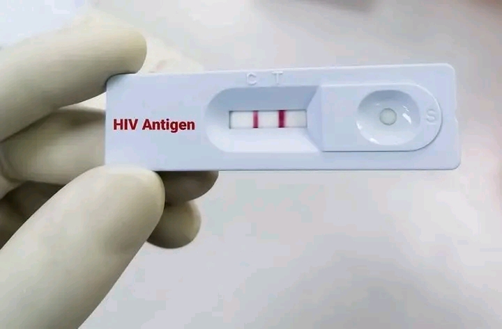 HIV test kit showing a positive result, highlighting rising HIV cases among Gen Z